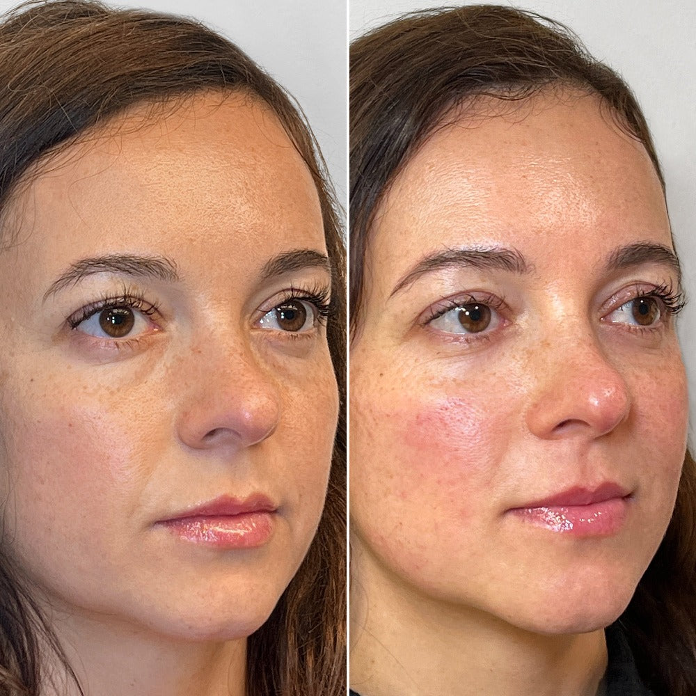 FaceFix: SkinVive – Beauty Fix MedSpa