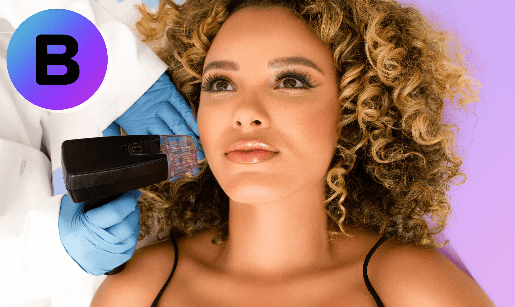 5 Benefits of the Morpheus8 Treatment