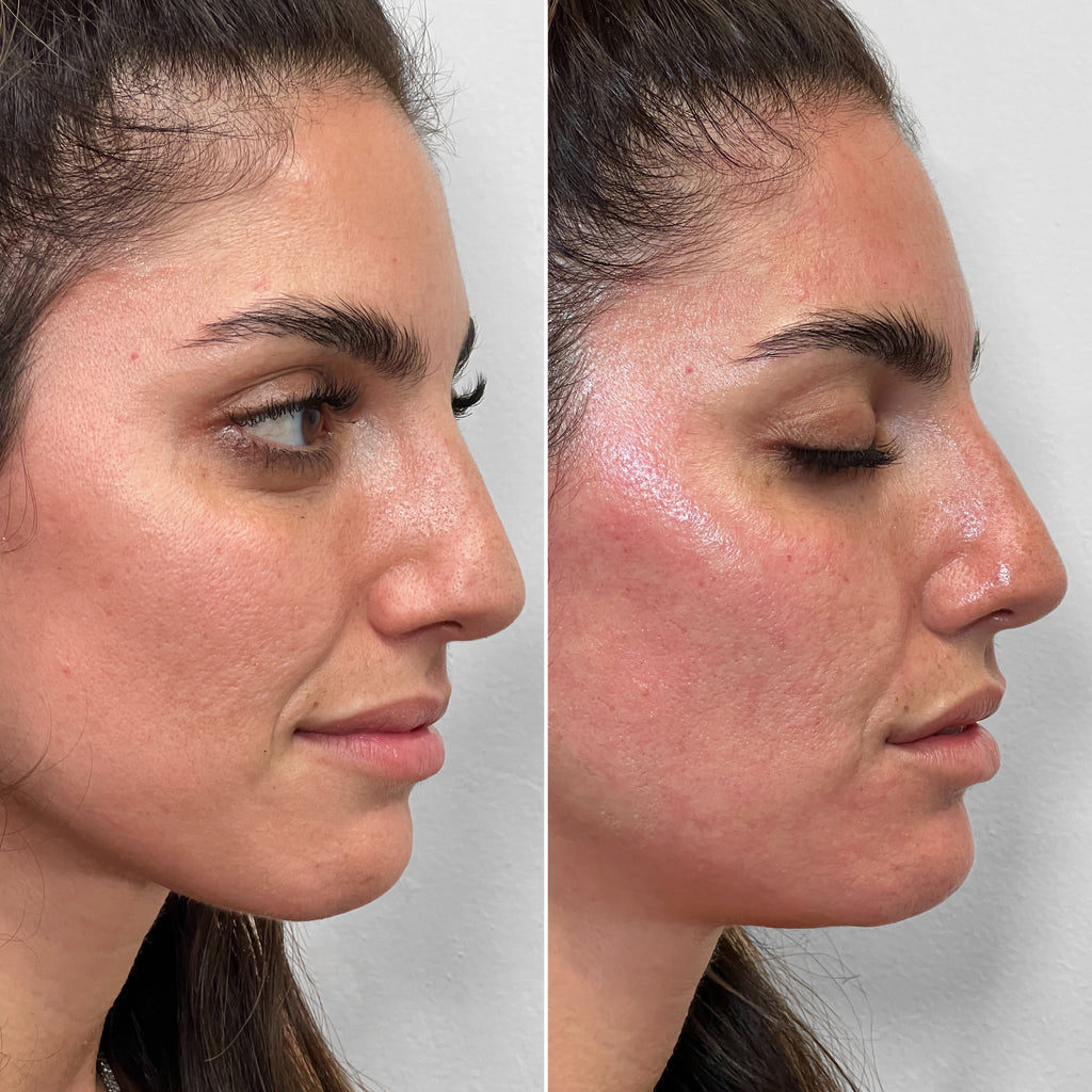 FaceFix: Salmon DNA – Beauty Fix MedSpa