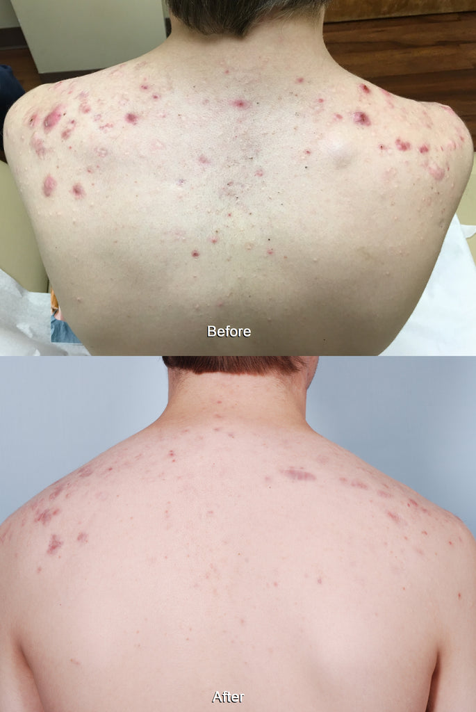 SkinFix: IPL – Beauty Fix MedSpa