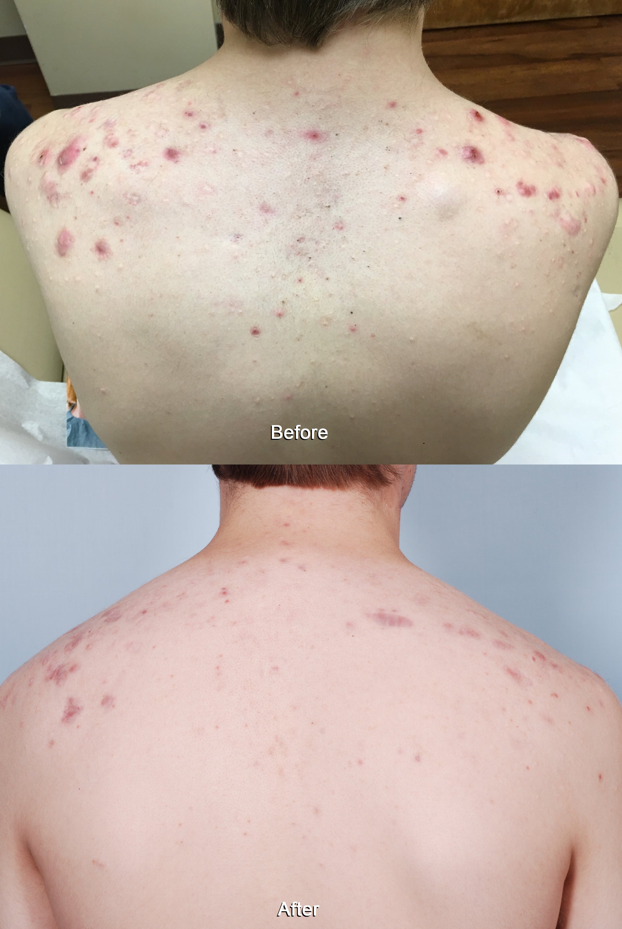 SkinFix: IPL – Beauty Fix MedSpa