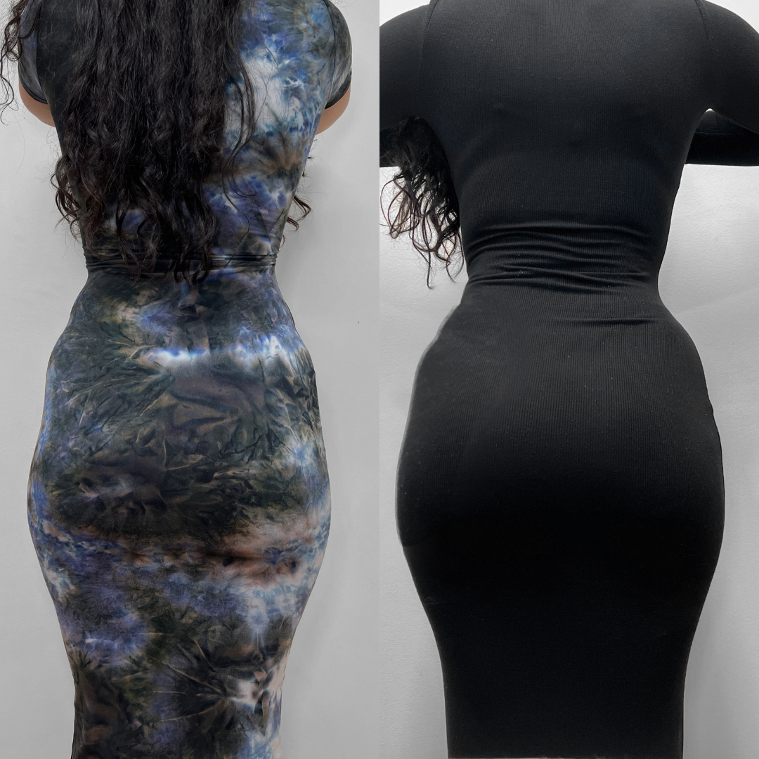 BootyFix: Radiesse Butt Lift – Beauty Fix MedSpa