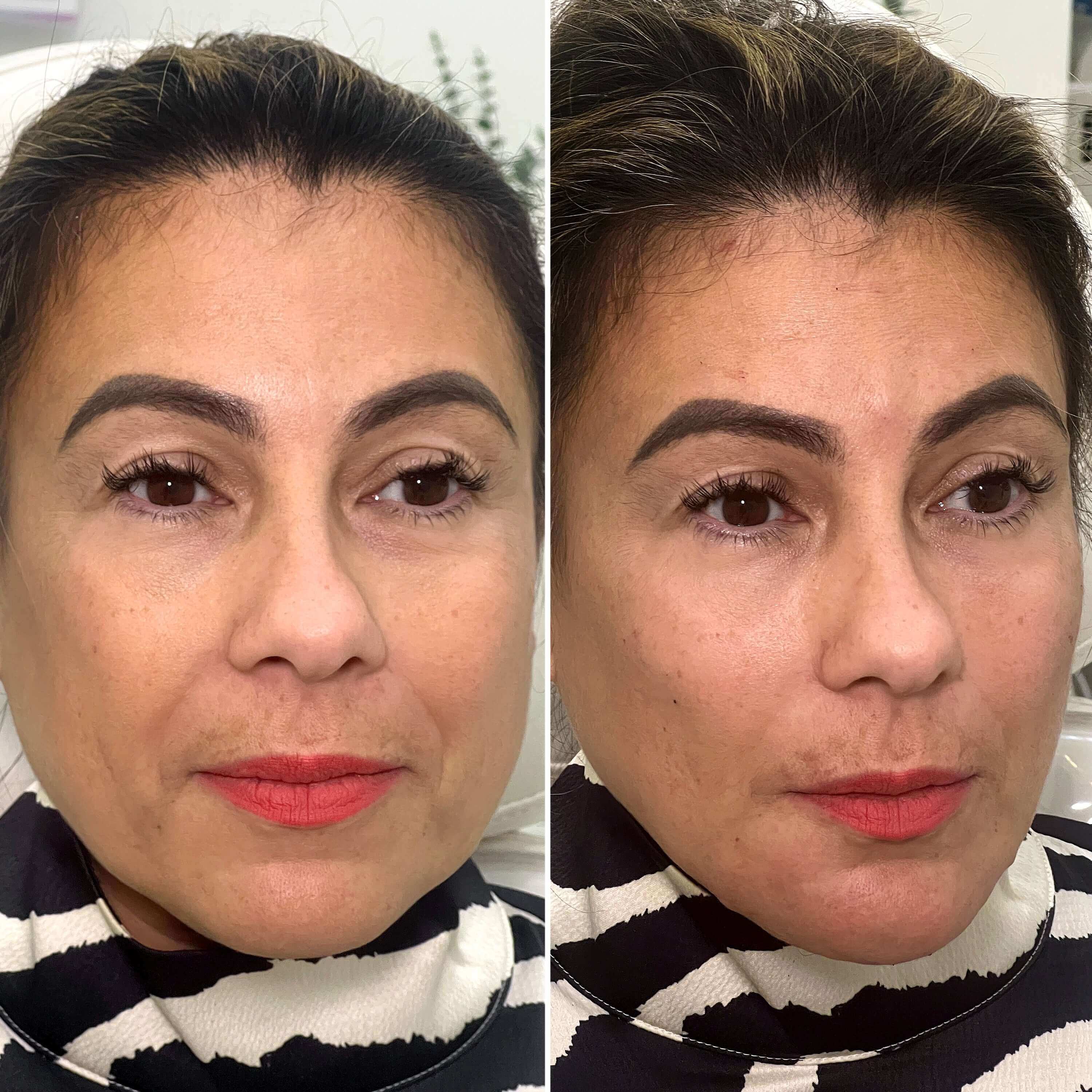 美容皮膚医学BEAUTY #13(Vol.2 No.12 ChinFix: Filler | BeautyFix MedSpa - (212) 366-4787