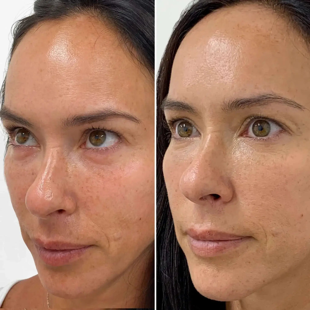 SkinFix: Exosomes – Beauty Fix MedSpa