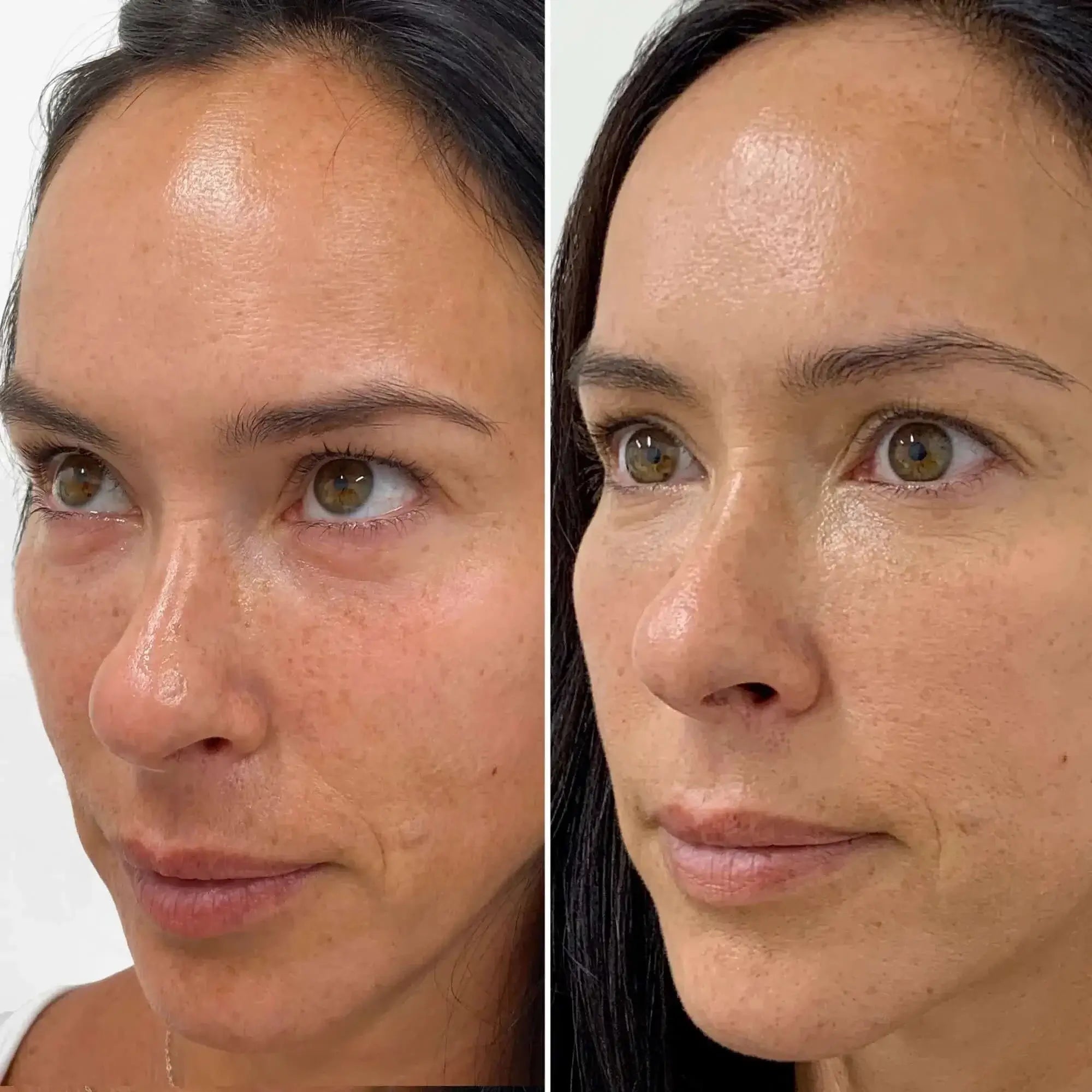 SkinFix: Exosomes – Beauty Fix MedSpa