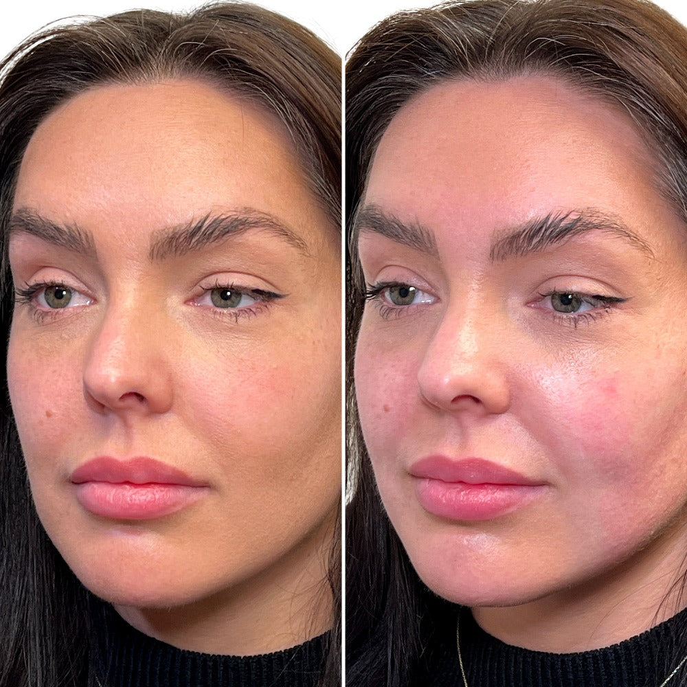FaceFix: SkinVive – Beauty Fix MedSpa