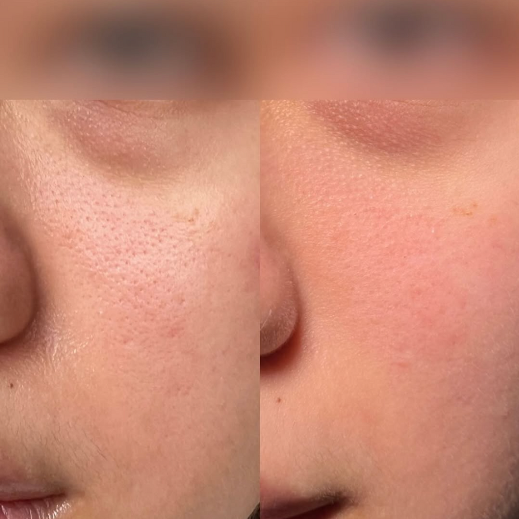 SkinFix: K-Beauty Botox Facial – Beauty Fix MedSpa