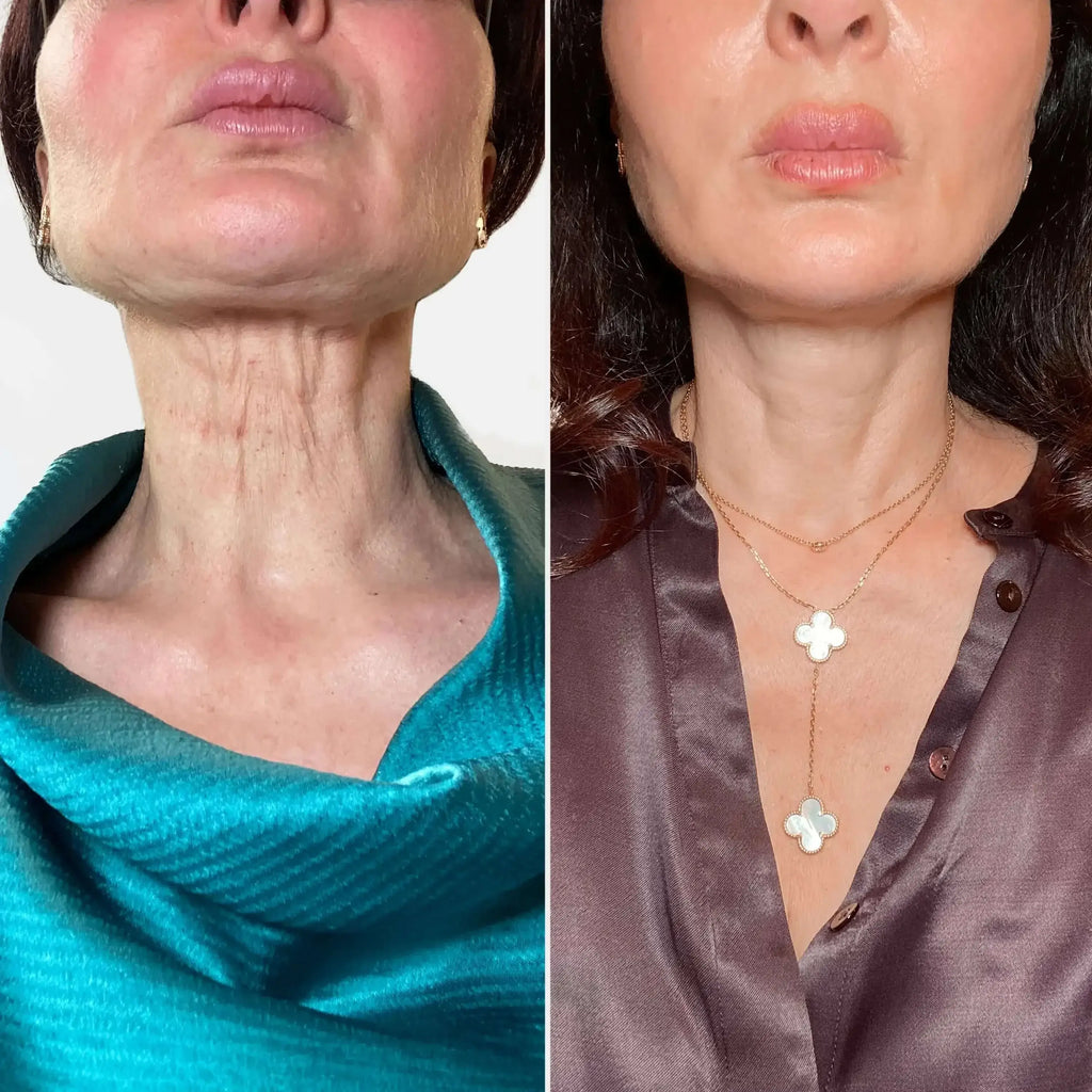 SkinFix: Exosomes – Beauty Fix MedSpa