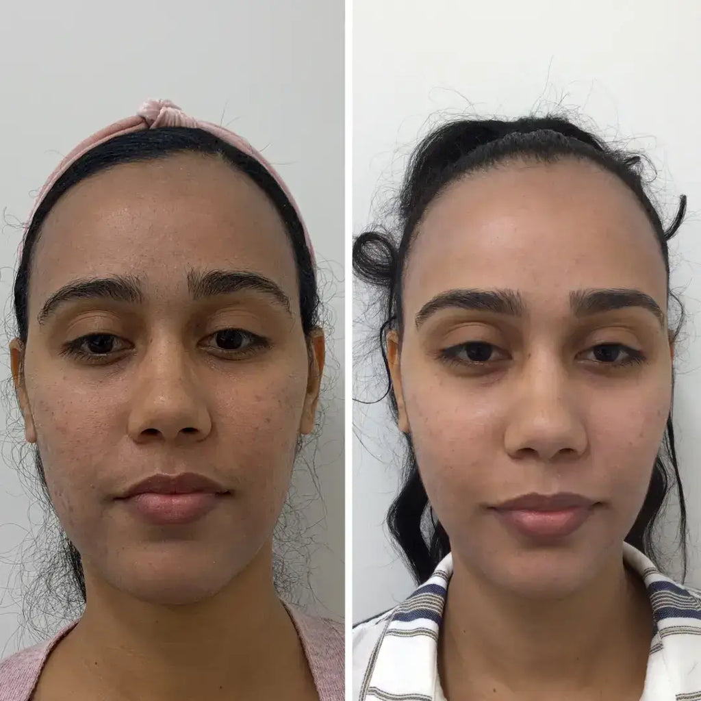 SkinFix Membership – Beauty Fix MedSpa