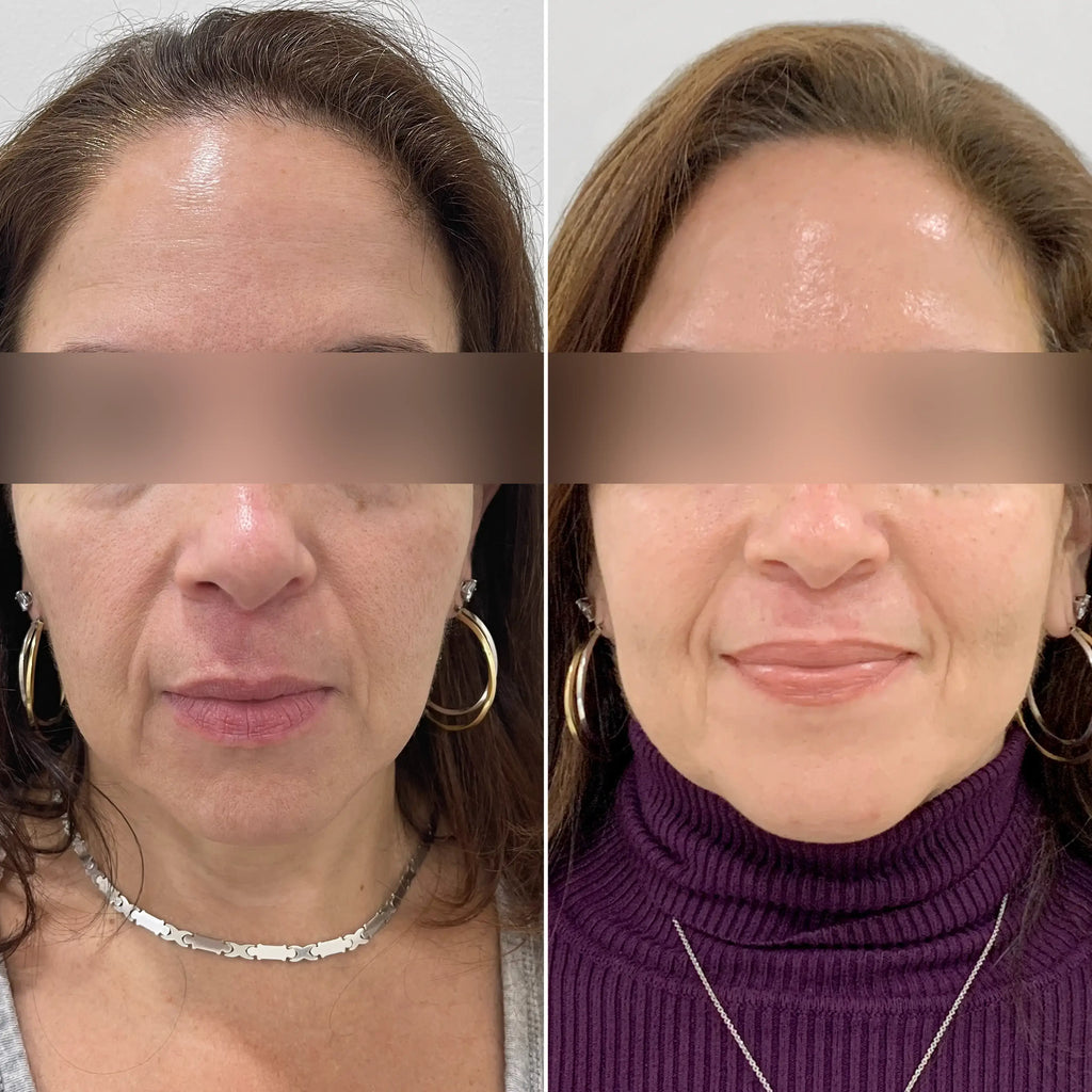 SkinFix Membership – Beauty Fix MedSpa