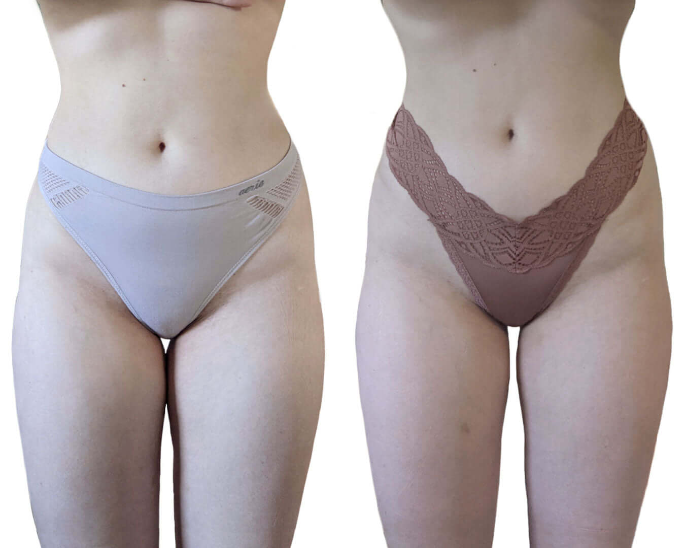 BodyFix: CoolSculpting® Elite – Beauty Fix MedSpa