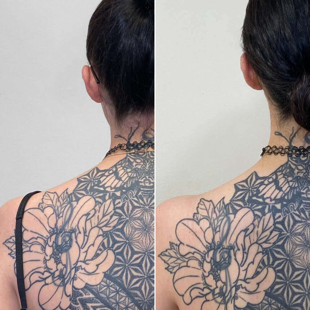 BodyFix: TrapTox – Beauty Fix MedSpa