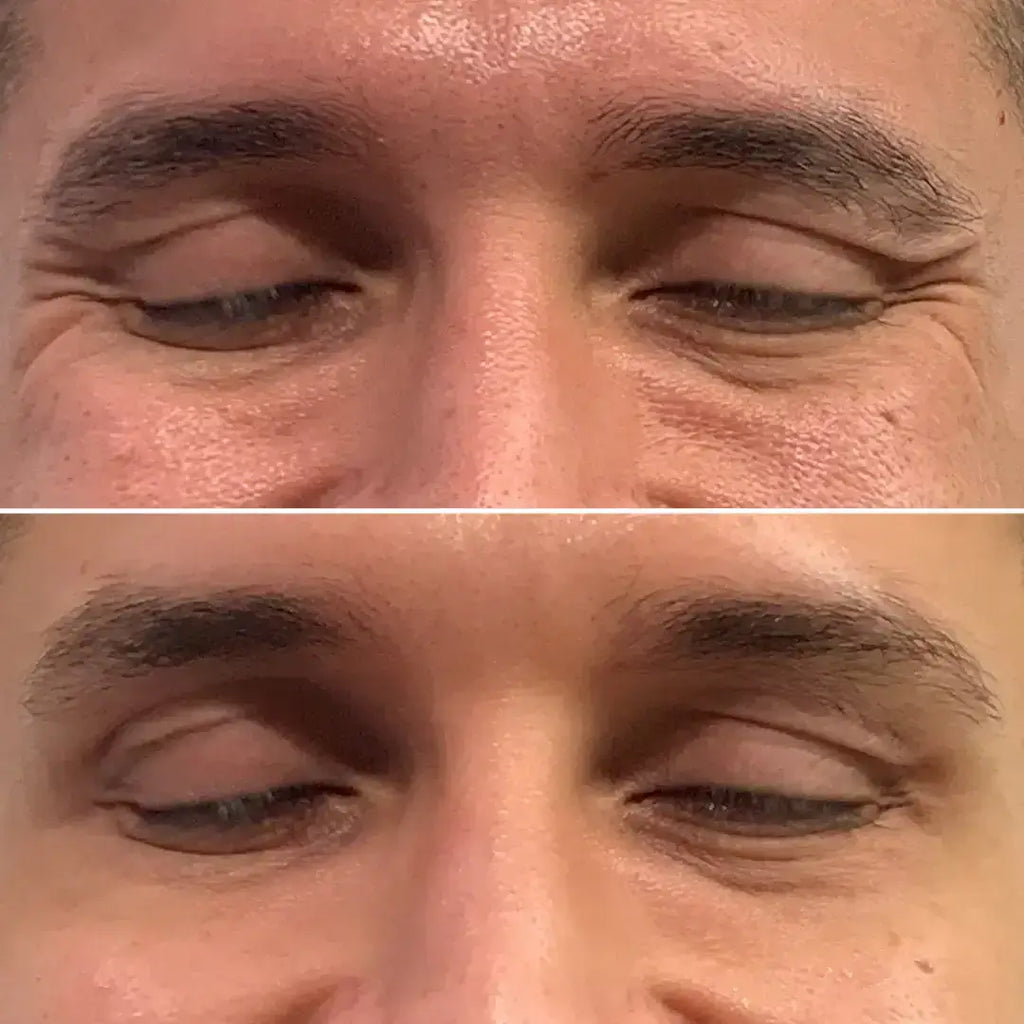 WrinkleFix: Unlimited Toxins Membership – Beauty Fix MedSpa