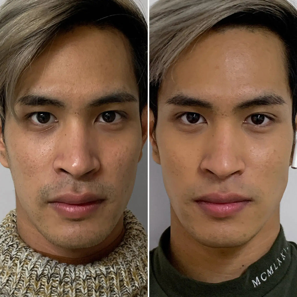 SkinFix: Resurfacing Facial – Beauty Fix MedSpa