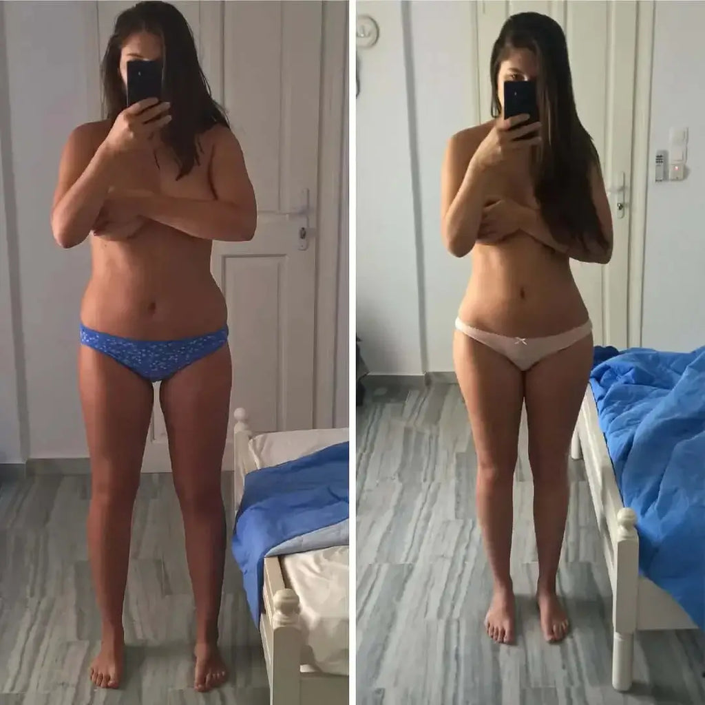 BodyFix: Liposuction – Beauty Fix MedSpa