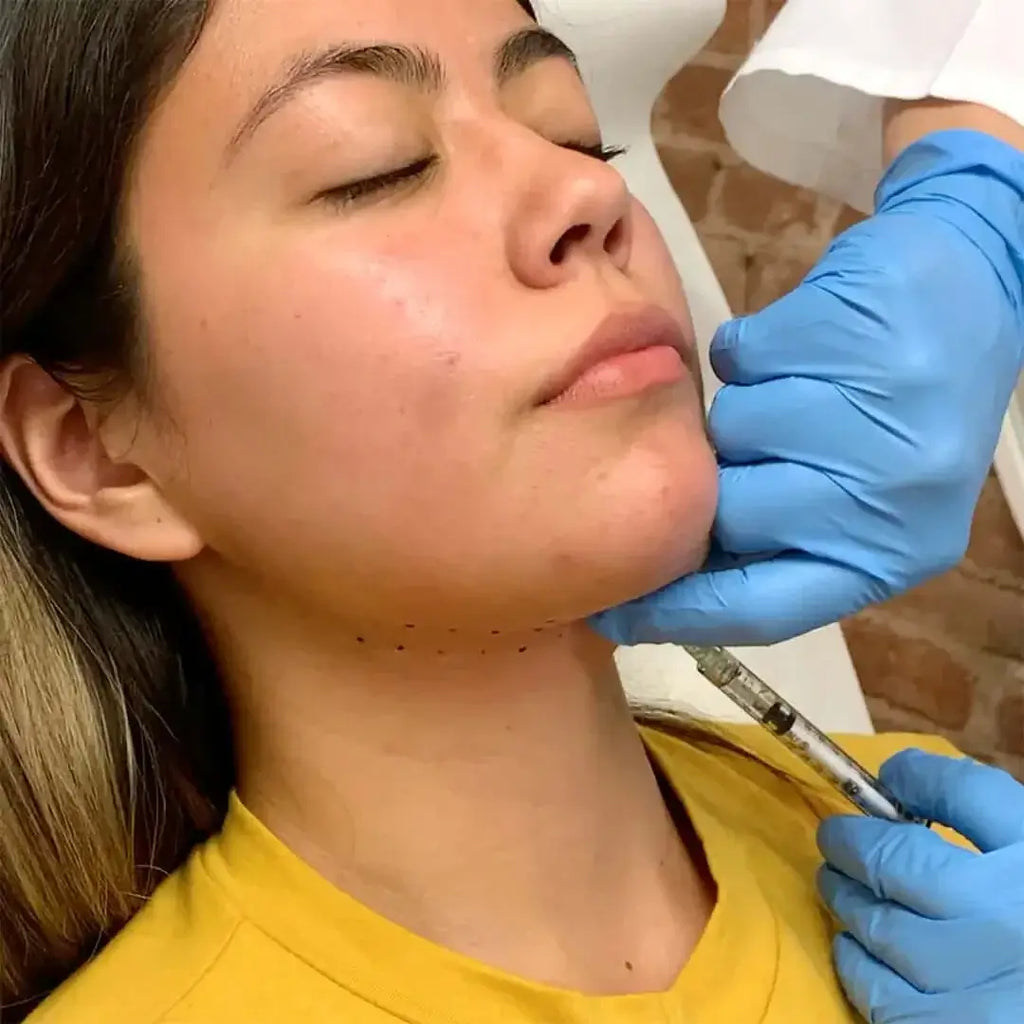 ChinFix: Kybella – Beauty Fix MedSpa