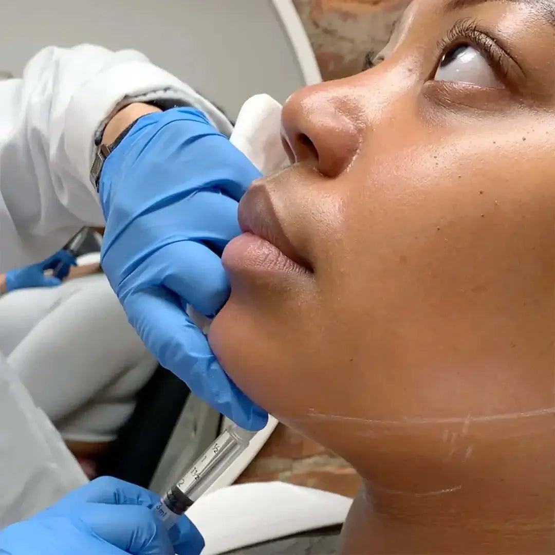 ChinFix: Kybella – Beauty Fix MedSpa