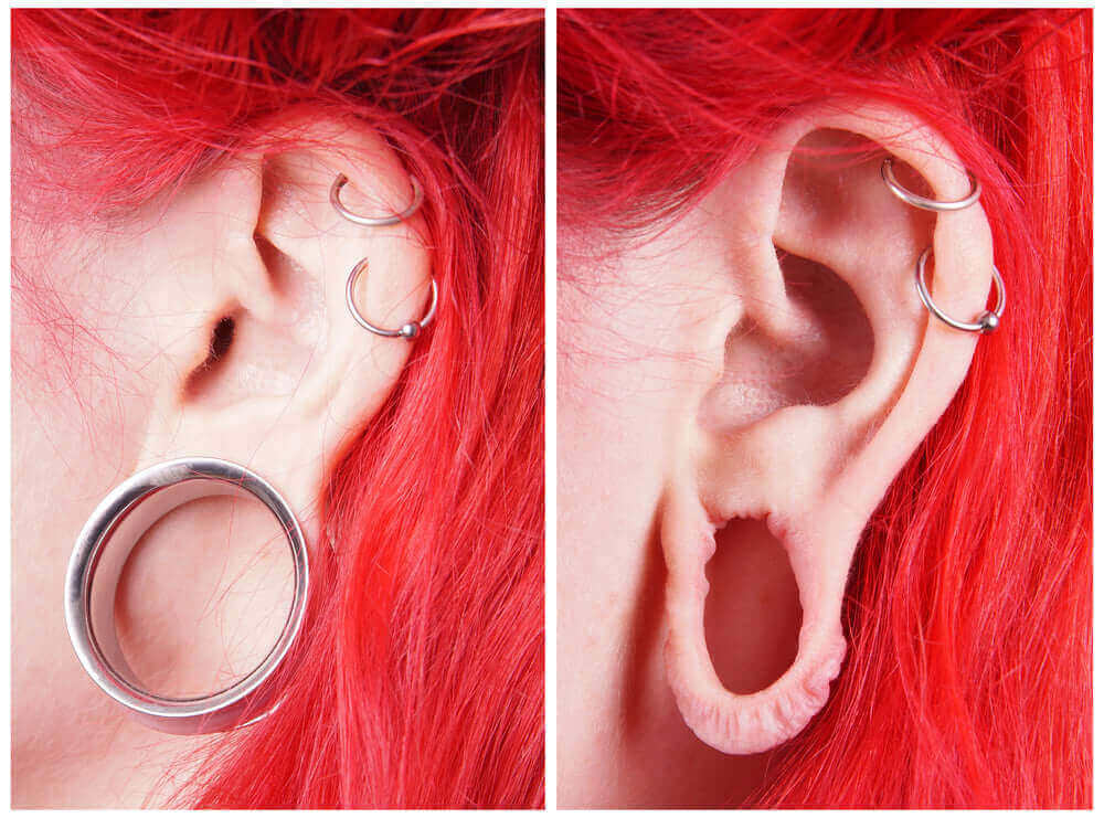 Earlobe Repair Earrings For Surgery Ripped Ear From Earring Shop