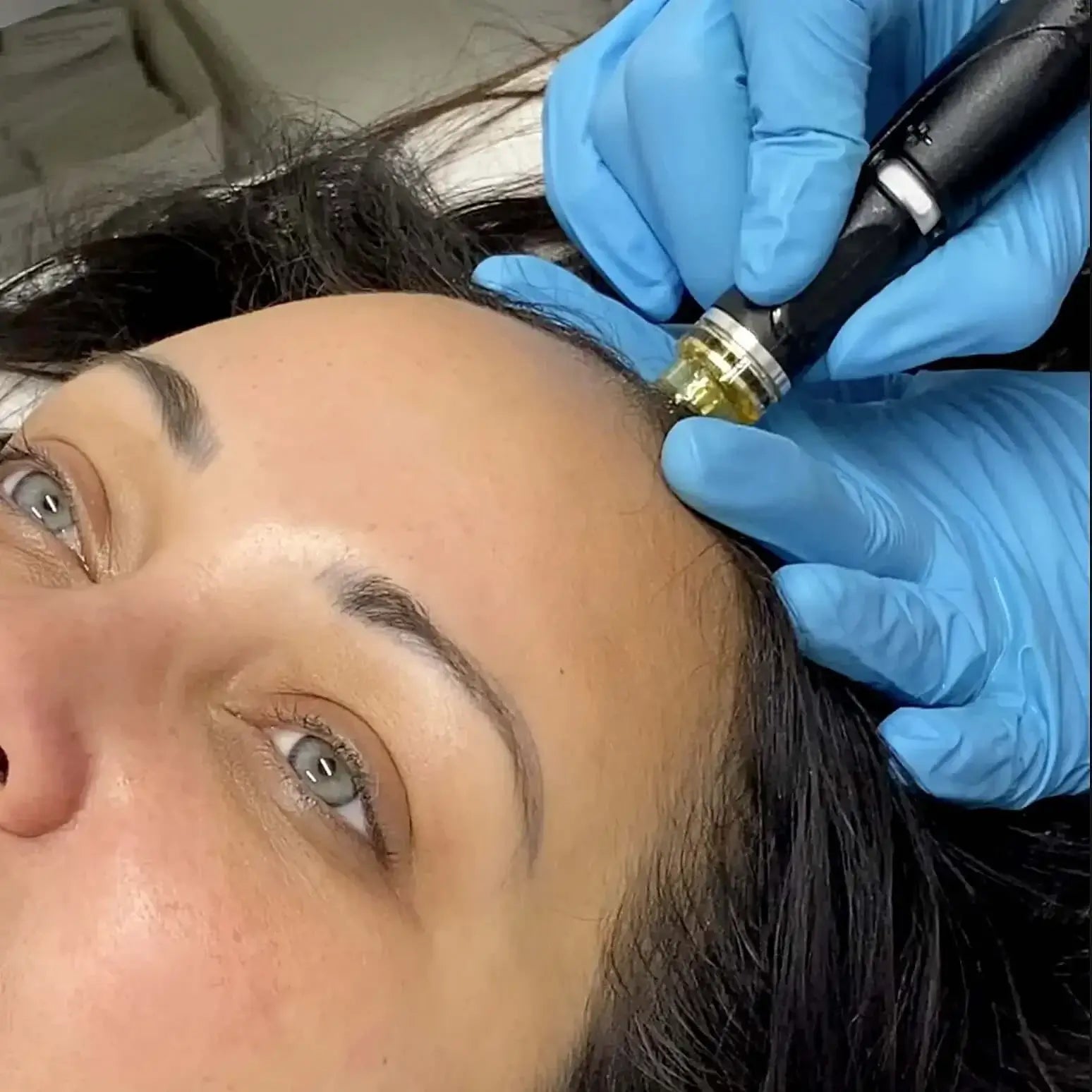 HairFix: Hydrafacial Keravive – Beauty Fix MedSpa