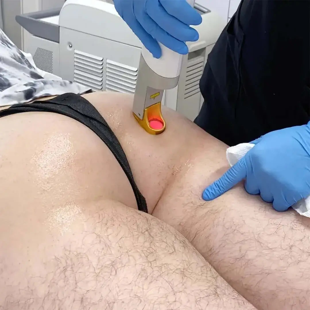HairFix: Laser Hair Removal (M) | BeautyFix MedSpa - (212) 366-4787