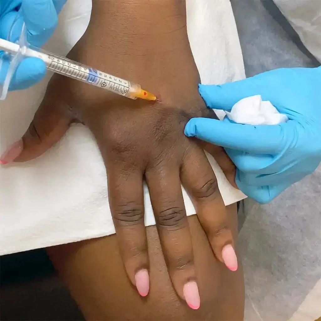 HandFix: Filler – Beauty Fix MedSpa