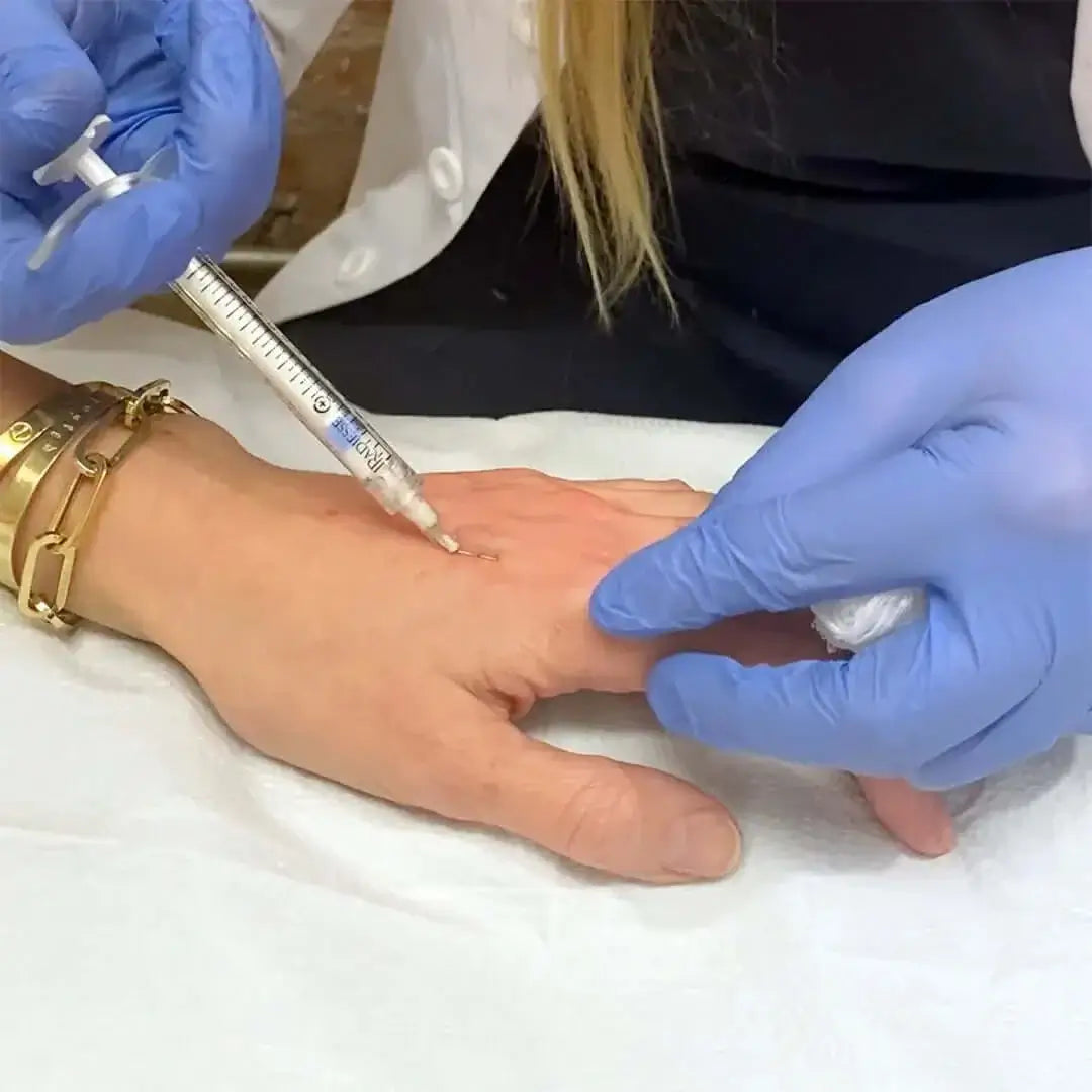 HandFix: Filler – Beauty Fix MedSpa