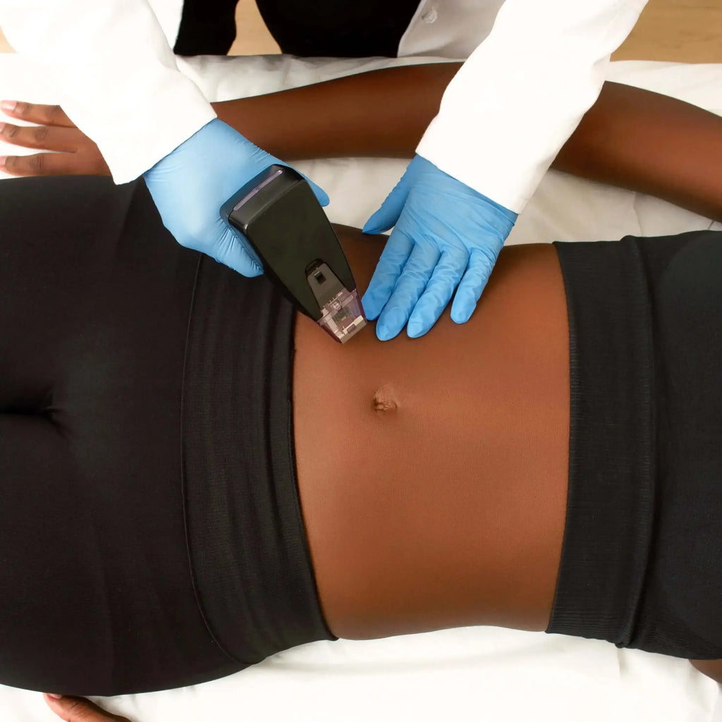 BodyFix: Morpheus8 – Beauty Fix MedSpa