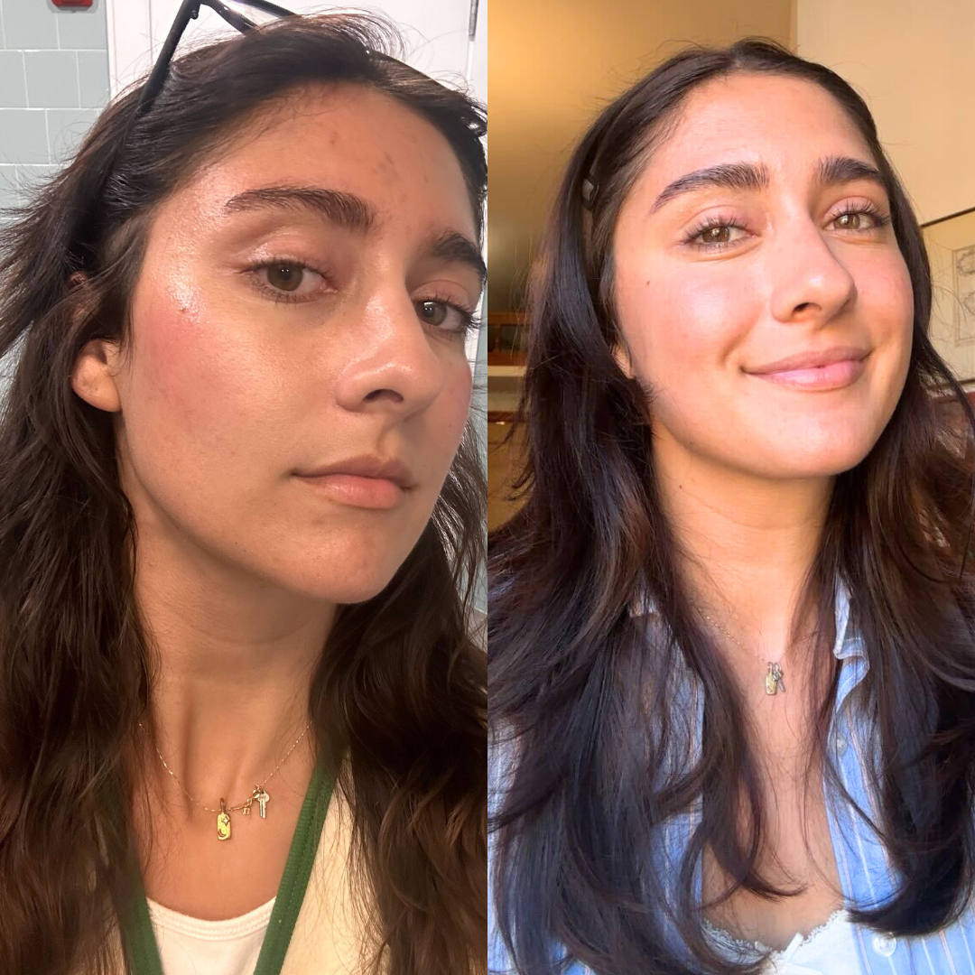 FaceFix: Salmon DNA – Beauty Fix MedSpa