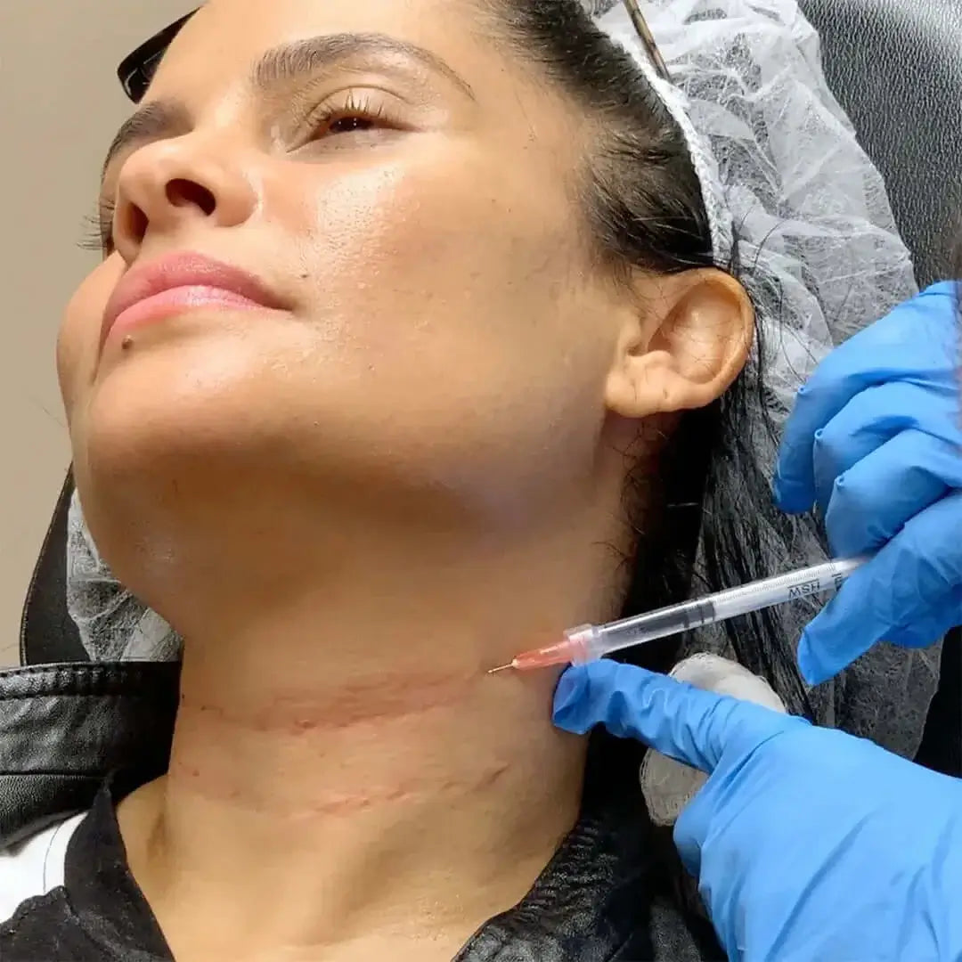 NeckFix: Filler – Beauty Fix MedSpa