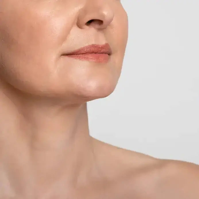 NeckFix: Threads | BeautyFix MedSpa - (212) 366-4787