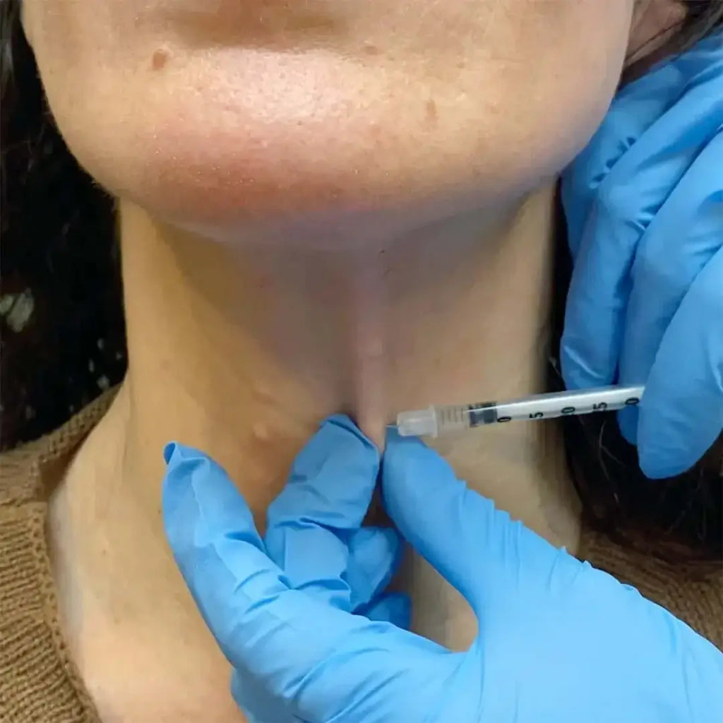 NeckFix: Nefertiti Lift – Beauty Fix MedSpa