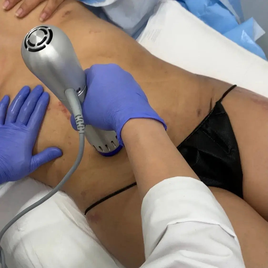 Post-OpFix: Z Wave – Beauty Fix MedSpa