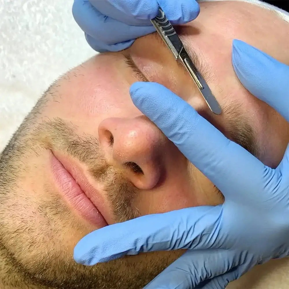 SkinFix: Dermaplaning – Beauty Fix MedSpa