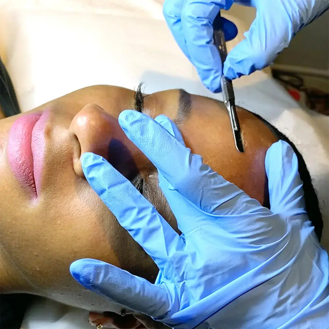 SkinFix: Dermaplaning – Beauty Fix MedSpa