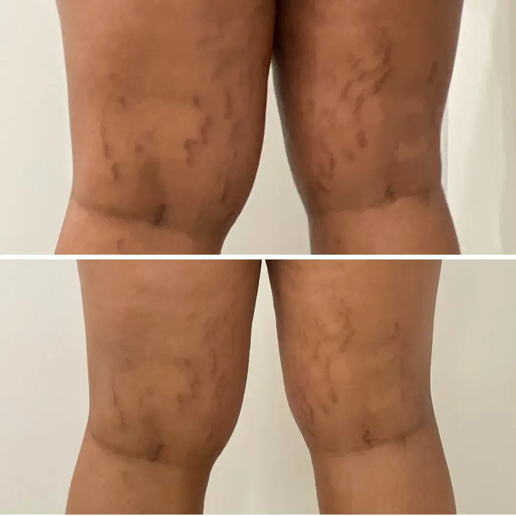 SkinFix: Resurfacing Facial – Beauty Fix MedSpa