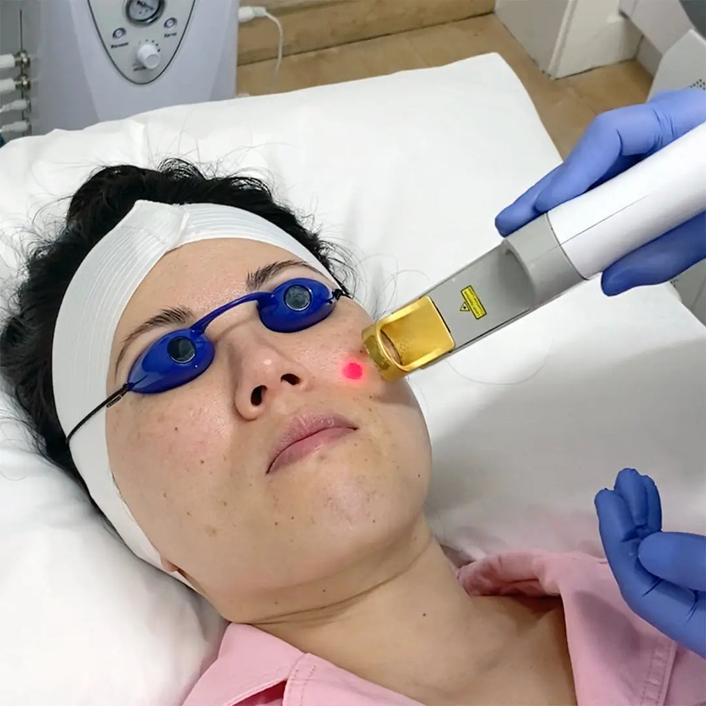 SkinFix: Laser Genesis – Beauty Fix MedSpa