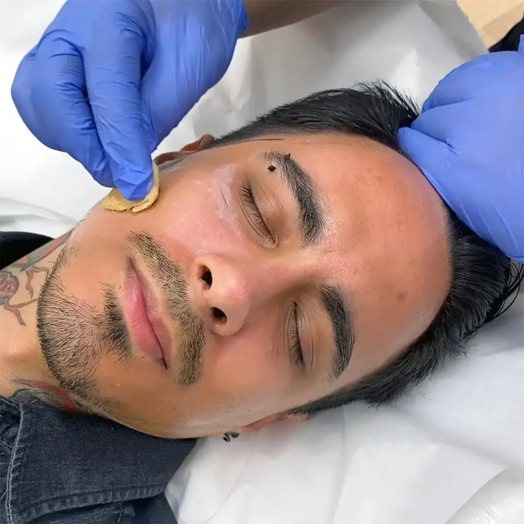 SkinFix: VI Peel – Beauty Fix MedSpa