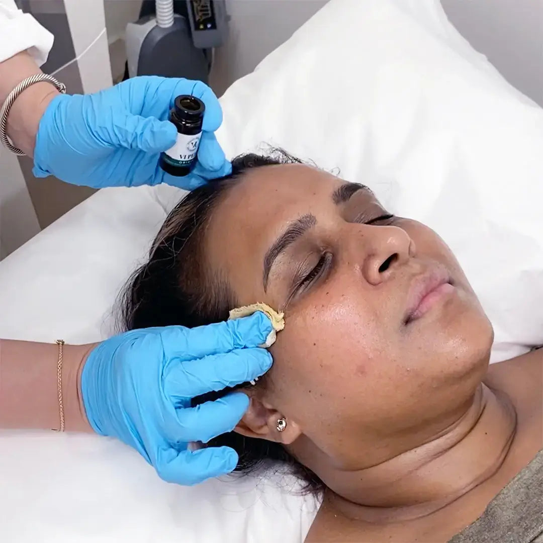 SkinFix: VI Peel – Beauty Fix MedSpa