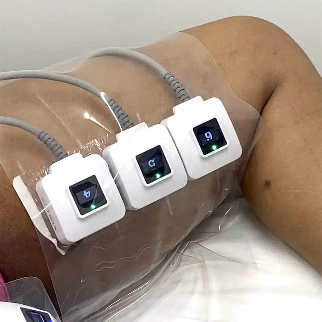 ThighFix: truSculpt iD – Beauty Fix MedSpa