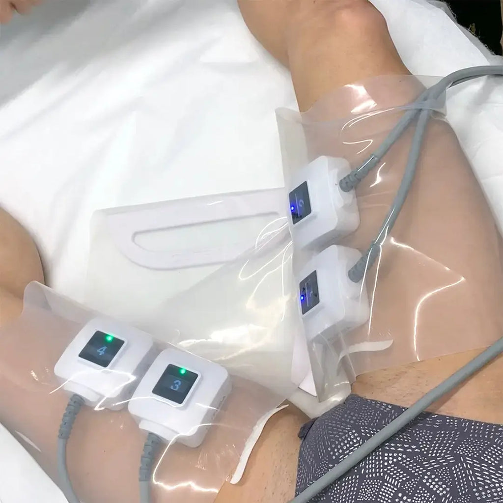 ThighFix: truSculpt iD – Beauty Fix MedSpa
