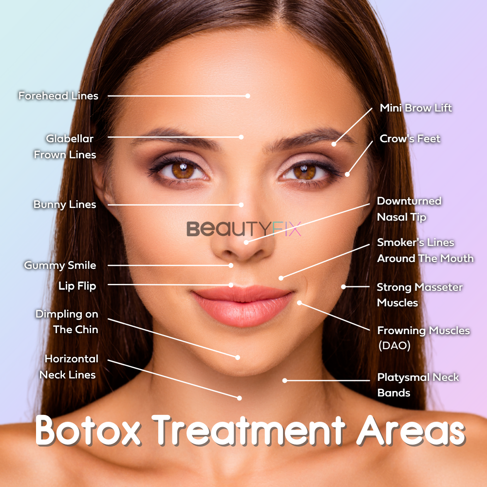 NoseFix: Botox – Beauty Fix MedSpa