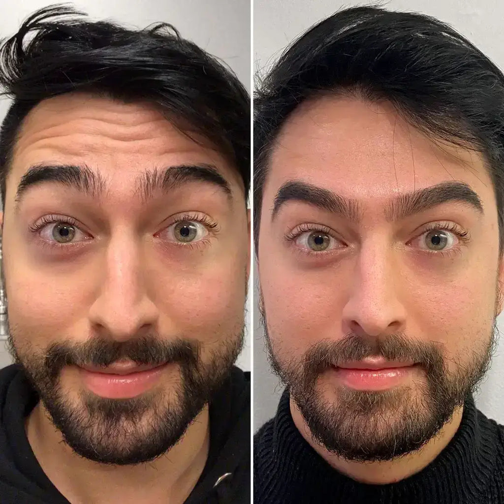 WrinkleFix: Unlimited Toxins Membership – Beauty Fix MedSpa