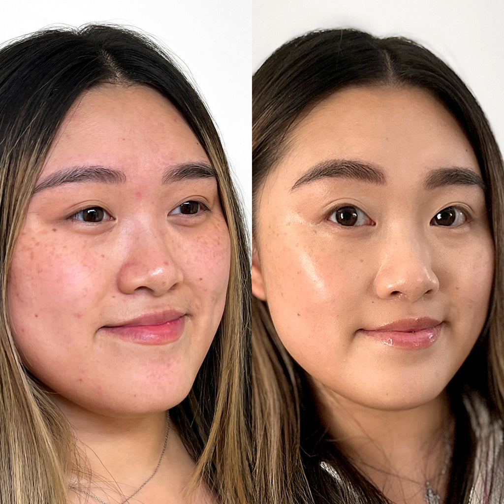 FaceFix: Salmon DNA – Beauty Fix MedSpa