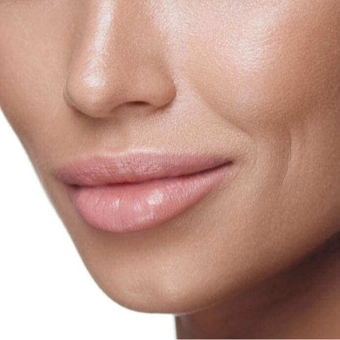 LipFix: Filler – Beauty Fix MedSpa