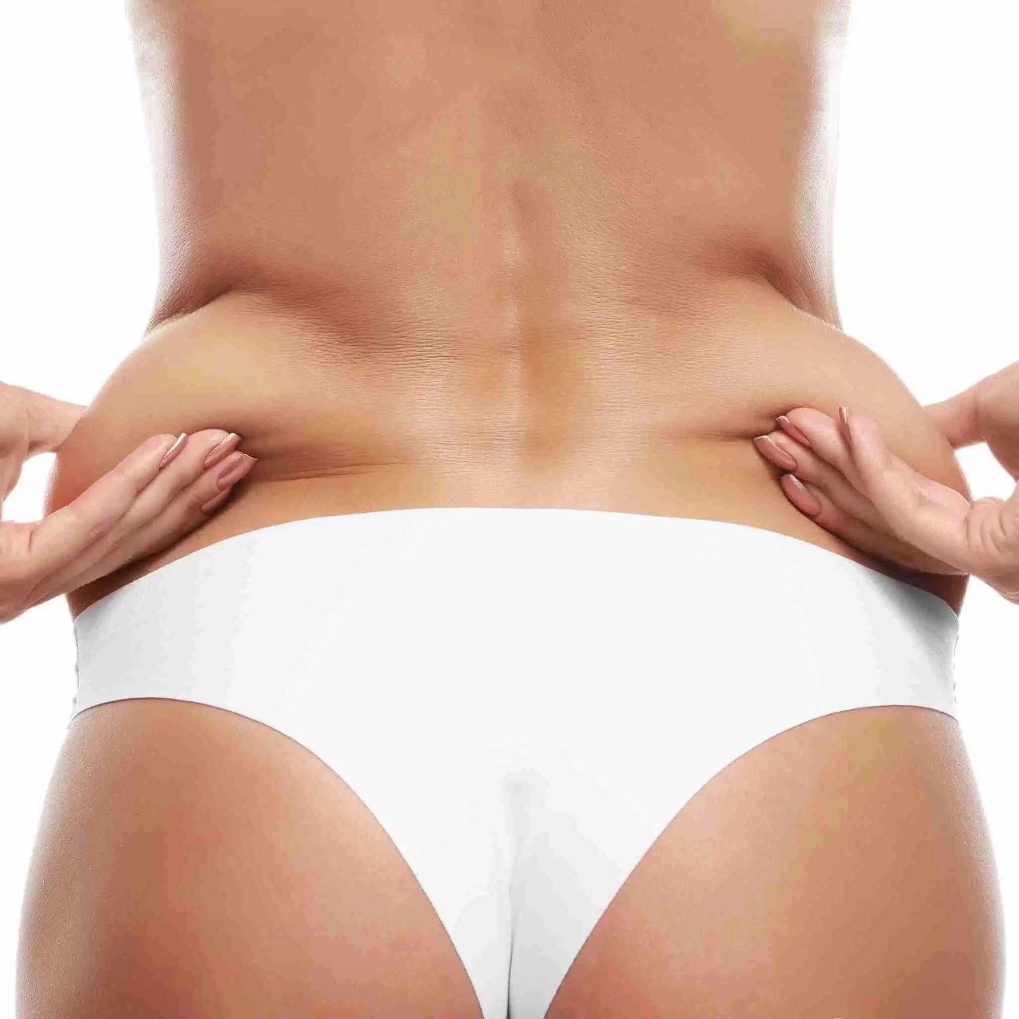 BodyFix: Liposuction – Beauty Fix MedSpa