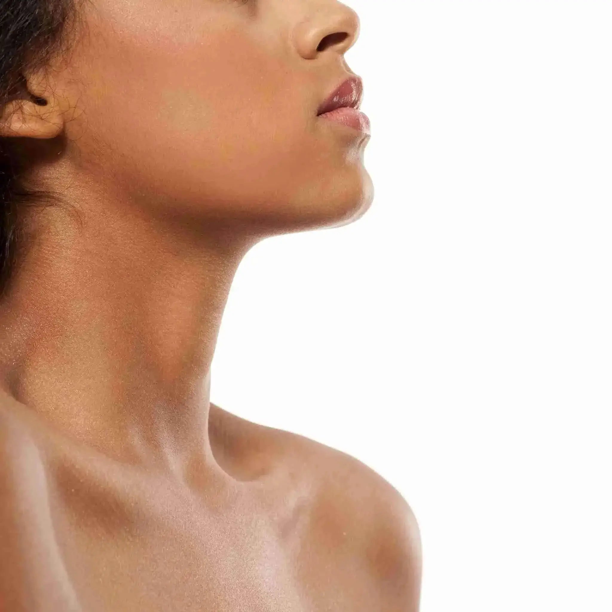 NeckFix: Filler – Beauty Fix MedSpa