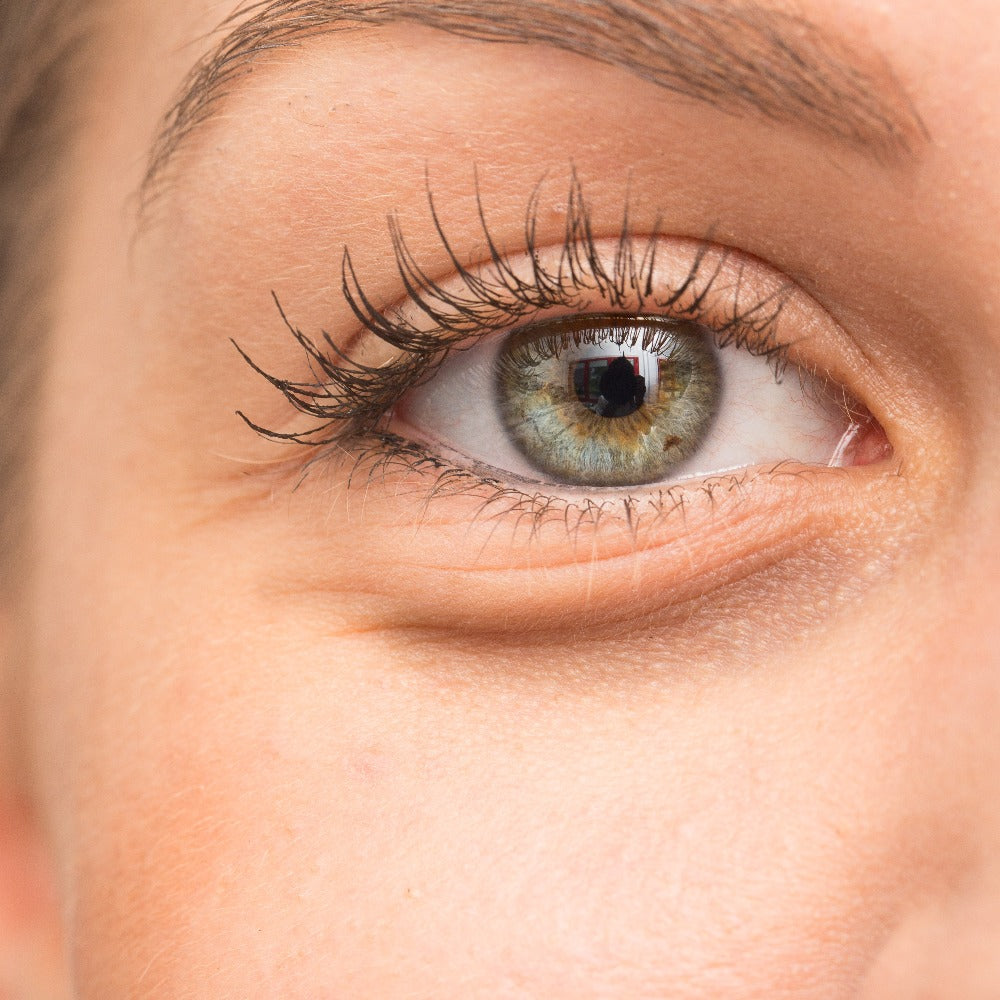 EyeFix: Botox (JellyRoll) – Beauty Fix MedSpa
