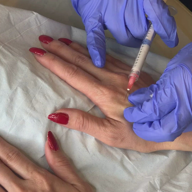 hand-filler-injection