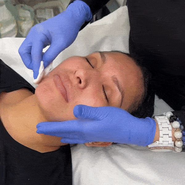SkinFix: Hydrafacial – Beauty Fix MedSpa