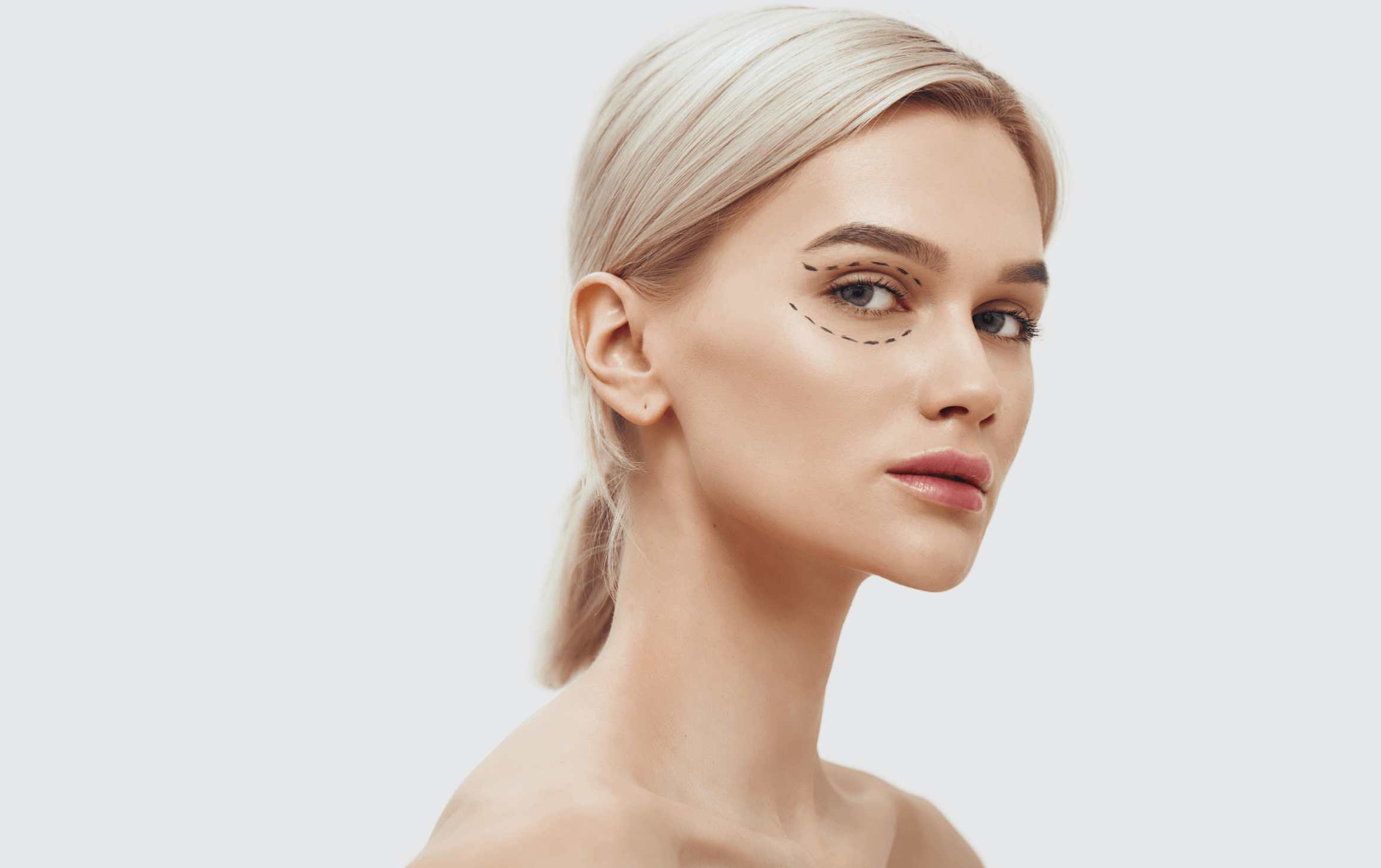Eyelid Surgery